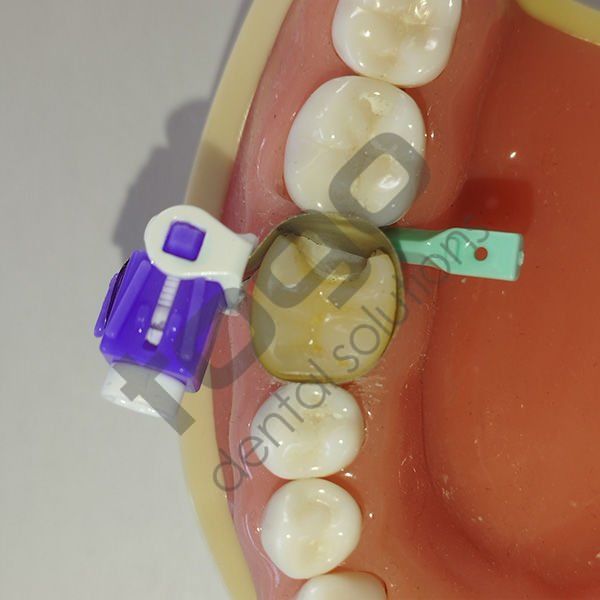Rhondium QuickConnect Anatomy Band Refill _ Premolar_Regular_ Small_50 Adet