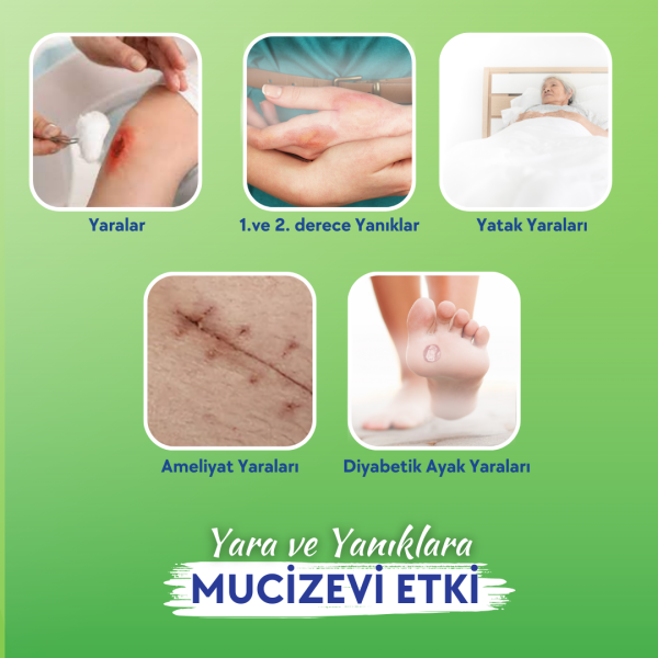 ACTOLIND® w SOLUTION 350 ml [Yara İyileştirme Solüsyonu]