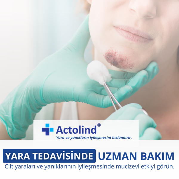 Actolind ® Solution Plus 100 ml | Yara Bakım Solüsyonu