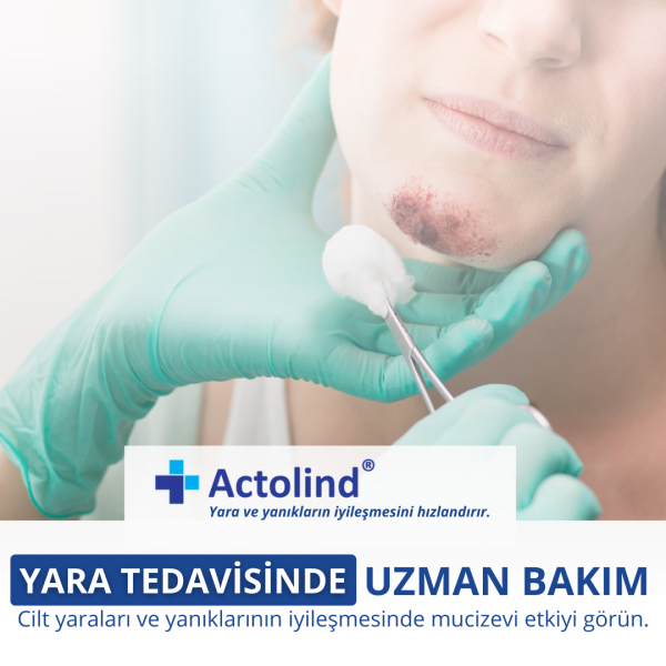 ACTOLIND® Solution Plus 1 L | Yara Bakım Solüsyonu