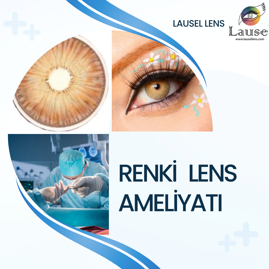 Renkli lens ameliyatı olur mu