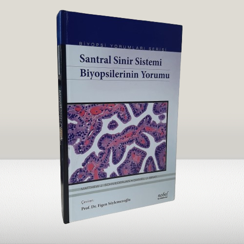 Santral Sinir Sistemi Biyopsilerinin Yorumu - Biyopsi Yorumları Serisi