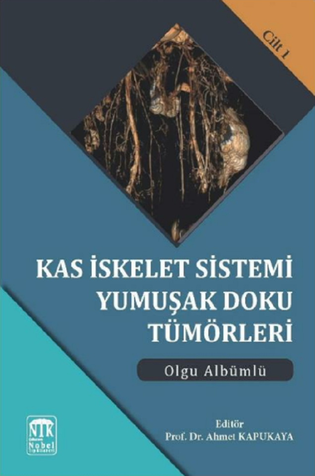 Kas İskelet Sistemi Yumuşak Doku Tümörleri Olgu Albümlü