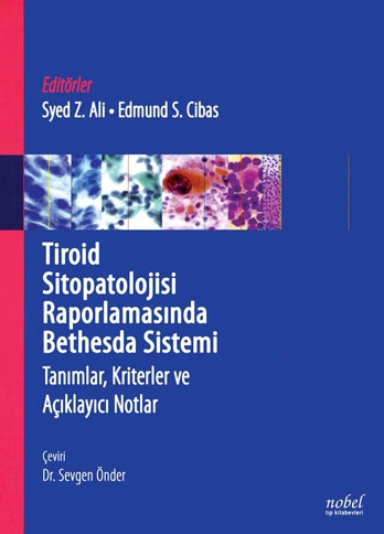 Tiroid Sitopatolojisi Raporlamasında Bethesda Sistemi: Tanımlar, Kriterler ve Açıklayıcı Notlar