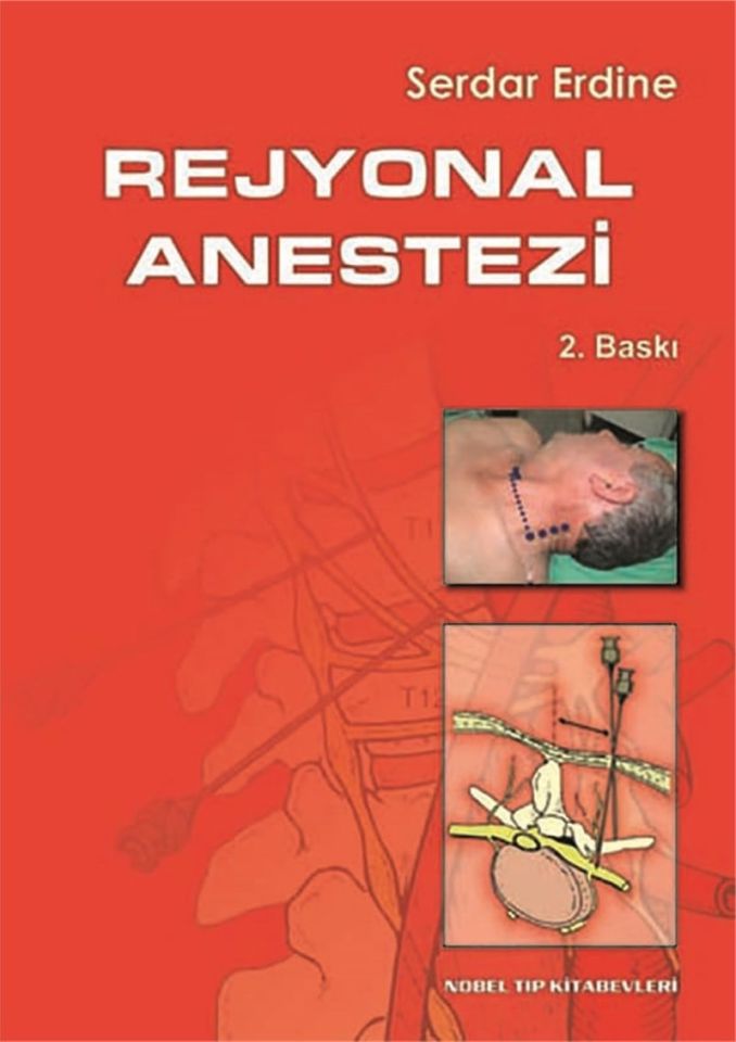 Rejyonel Anestezi