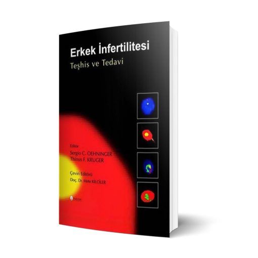 Erkek İnfertilitesi Teşhis ve Tedavi