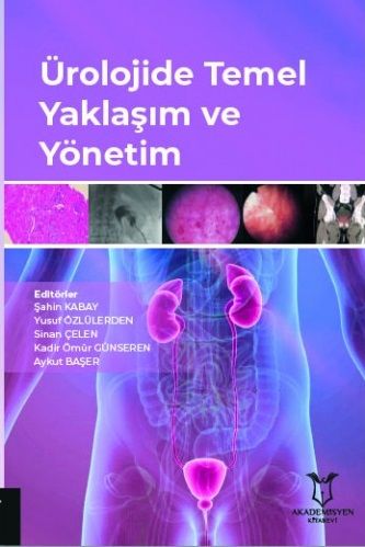 Ürolojide Temel Yaklaşım ve Yönetim