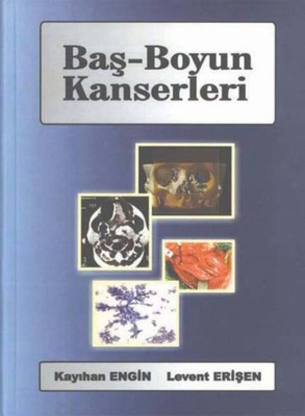 Baş-Boyun Kanserleri