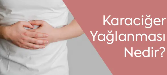 Karaciğer Yağlanması Nedir?