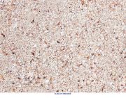 Natures Ocean - Bio Activ Live Aragonite Reef Substrate 2 - 4mm - Canlı Aragonit Kum 7,26 KG