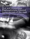 Oral and Intravenous Bisphosphonate Induced Osteon