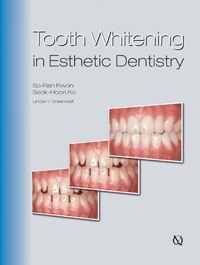 Tooth Whitening in Esthetic Dentistry