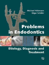 Problems in Endodontics Etiology, Diagnosis and Treatment