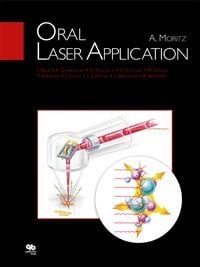 Oral Laser Application