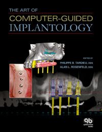The Art of Computer-Guided Implantology