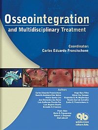 Osseointegration and Multidisciplinary Treatment