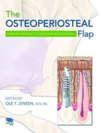 The Osteoperiosteal Flap