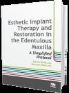 Esthetic Implant Restoration in the Edentulous Maxilla A Simplified Protocol