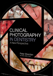 Clinical Photography in Dentistry