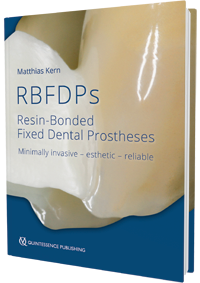 Resin-Bonded Fixed Dental Prostheses