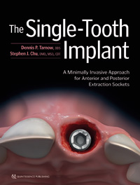 The Single-Tooth Implant A Minimally Invasive Approach for Anterior and Posterior Extraction Sockets