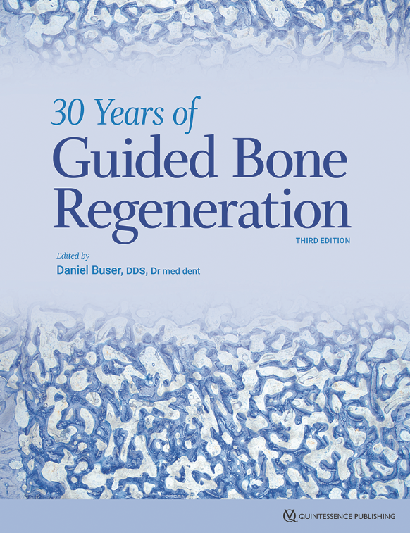 30 Years of Guided Bone Regeneration