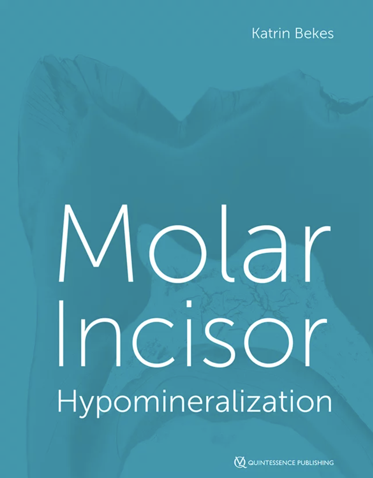 Molar Incisor Hypomineralization