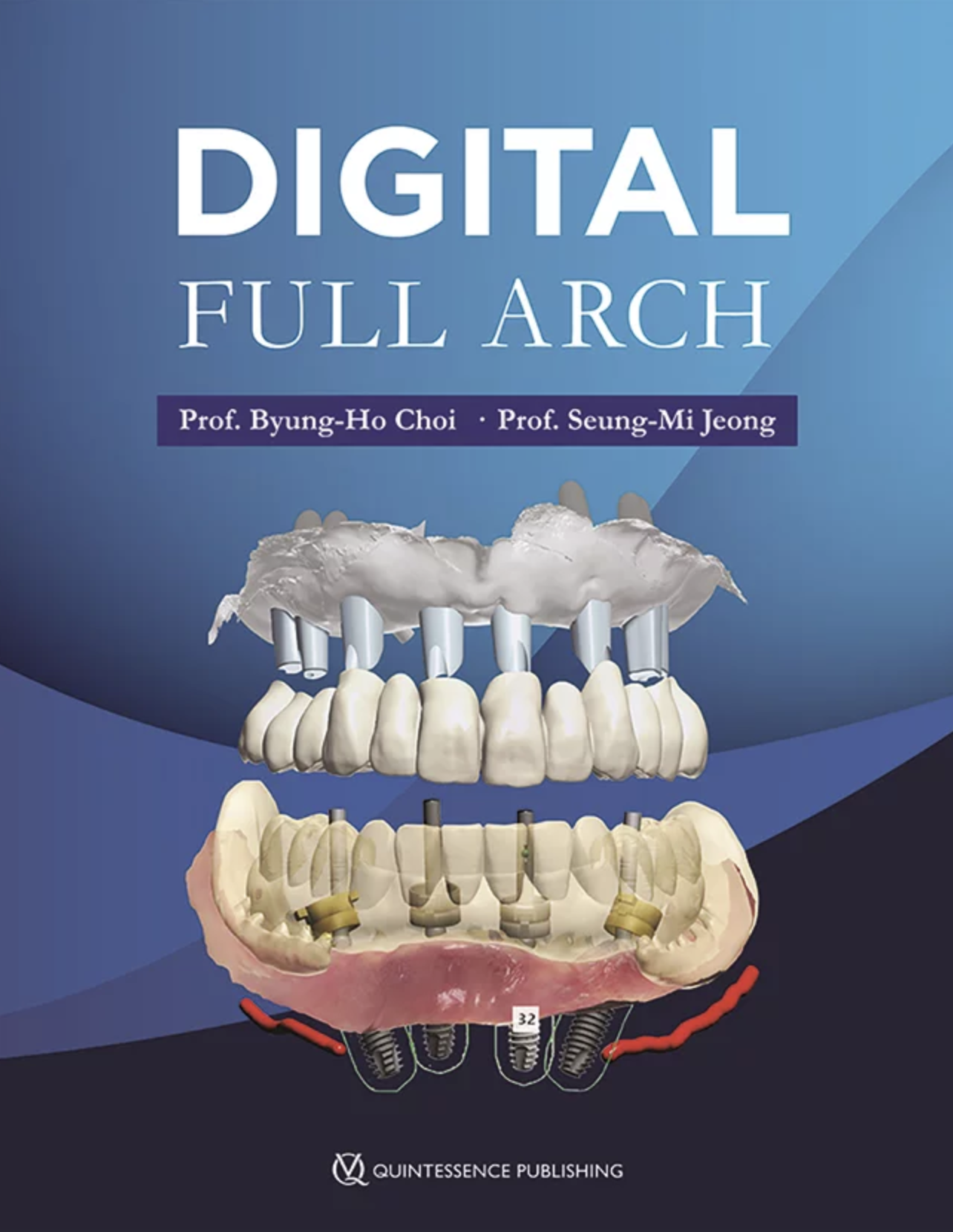 Digital Full Arch