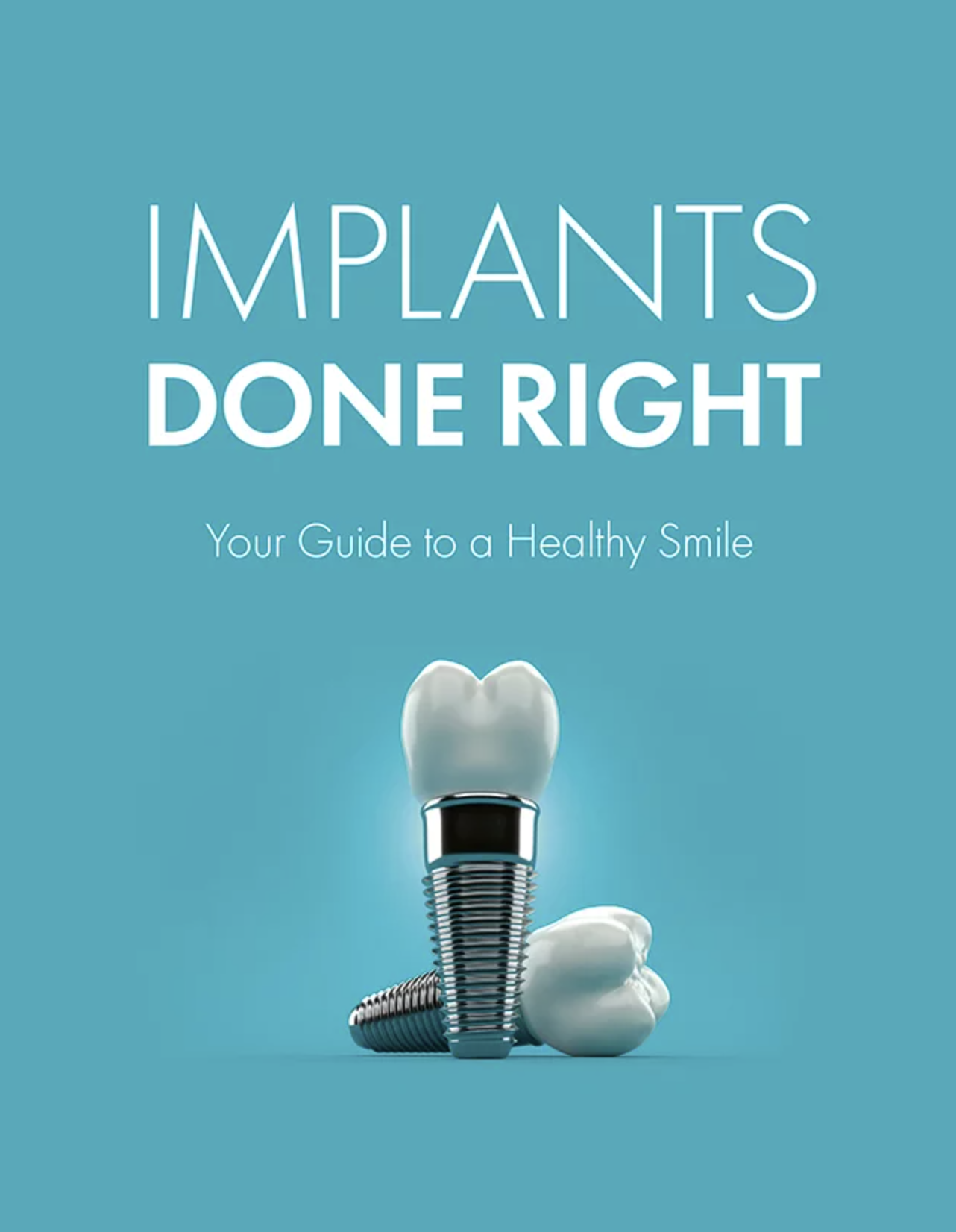Implants Done Right Your Guide to a Healthy Smile