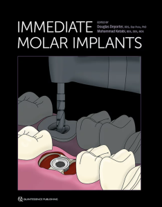 Immediate Molar Implants