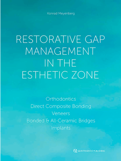 Restorative Gap Management in the Esthetic Zone