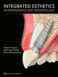 Integrated Esthetics in Periodontics and Implantology