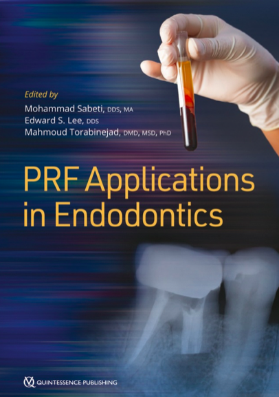 PRF Applications in Endodontics