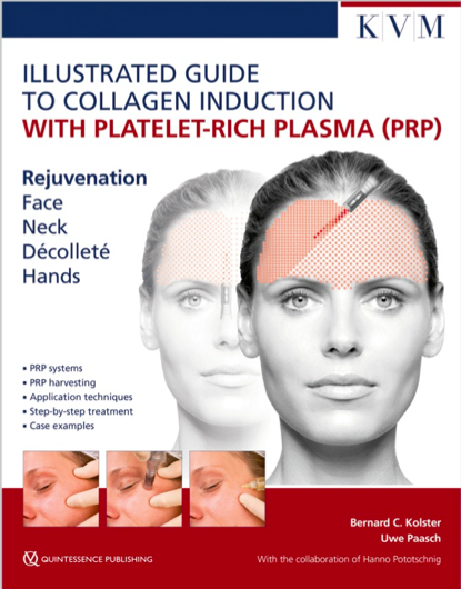 Illustrated Guide to Collagen Induction with Platelet-Rich Plasma (PRP)