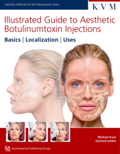 Illustrated Guide to Aesthetic Botulinumtoxin Injections