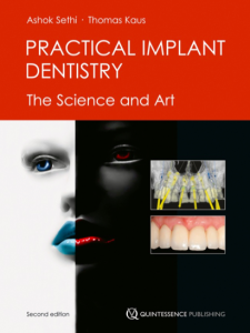Practical Implant Dentistry
