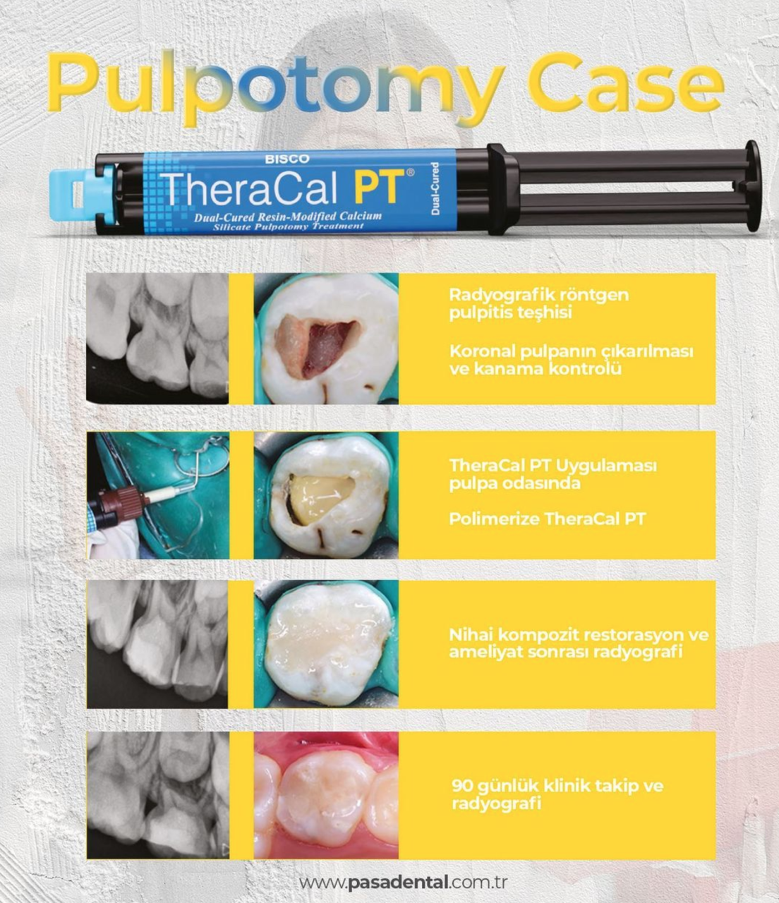 Theracal PT Ürün İncelemesi Prof Dr Bilge Hakan Şen