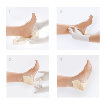 Lohmann Rauscher Suprasorb P Sensitive Silikon Yara Örtüsü