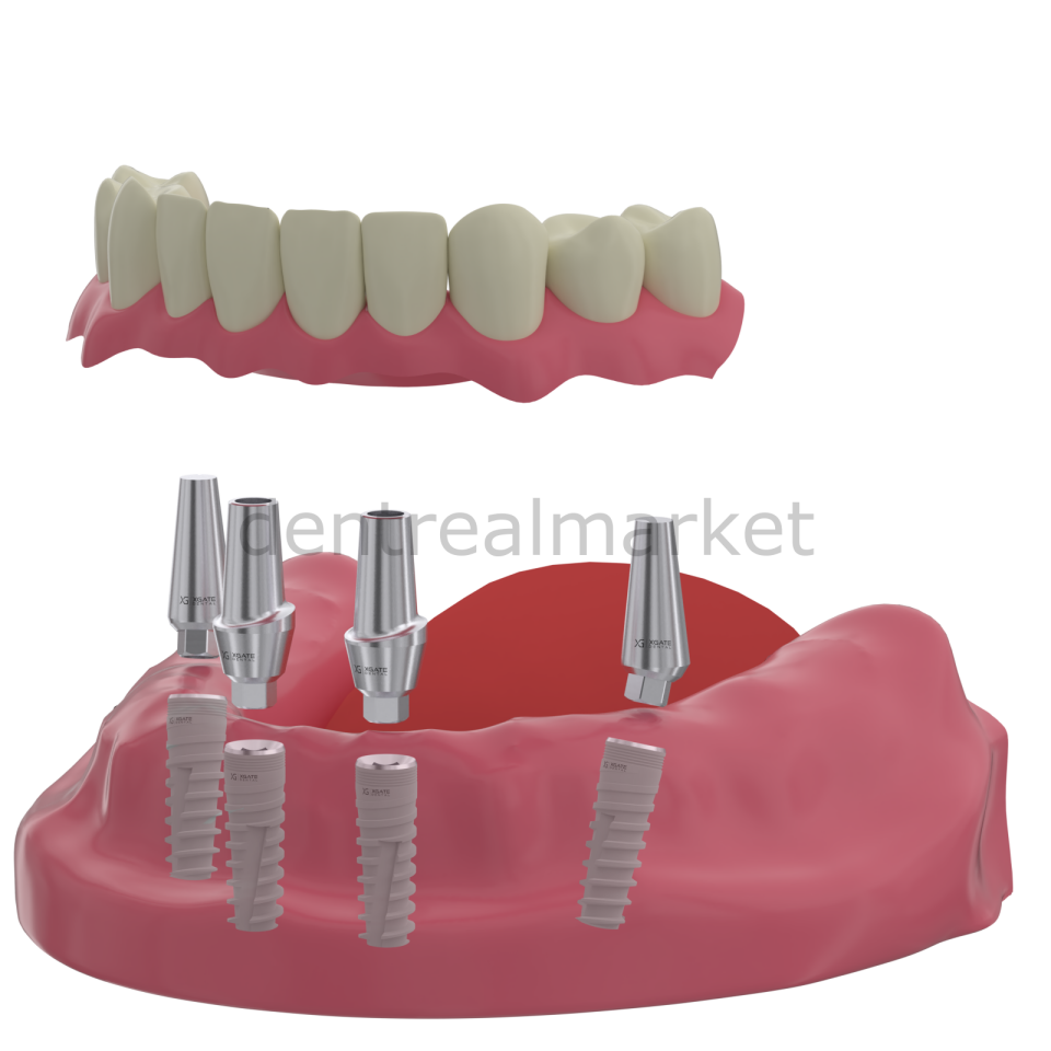 X3 İnternal Hex İmplant Body - Çap 4,2 mm - Tek Platform İmplant