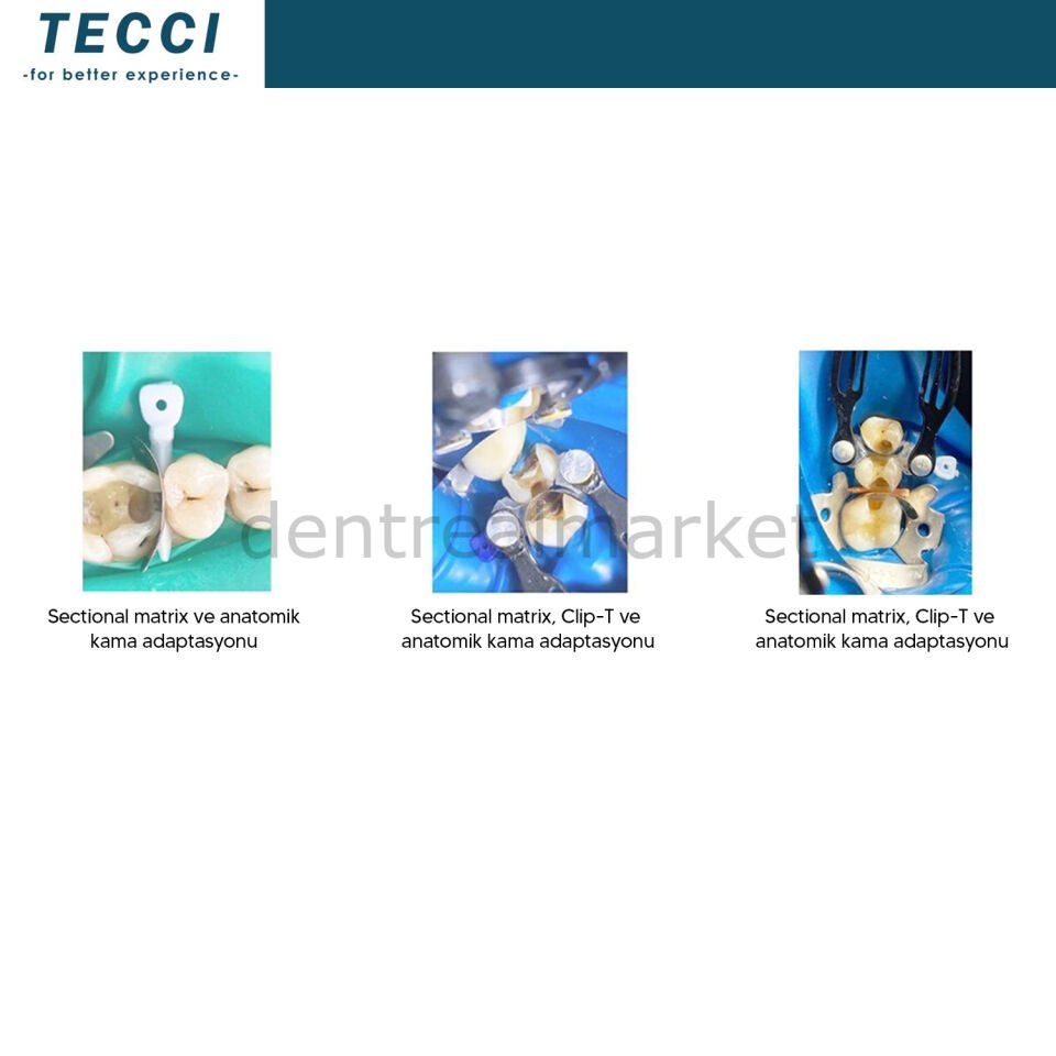 Tecci Bölgesel Matrix Bandı Paslanmaz Çelik - 400 Seri