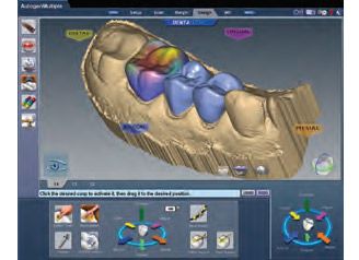 Arctica Cad- Cam Sistemi Full