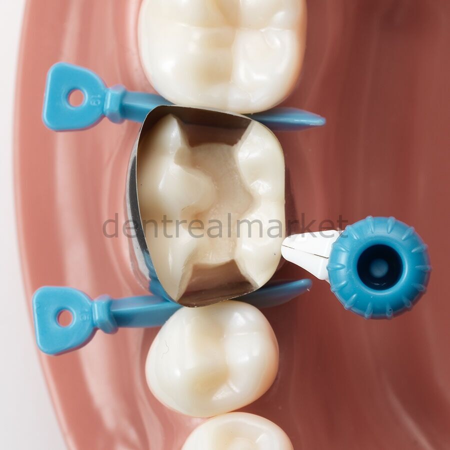 Palodent 360 Çevresel Matrix Refil