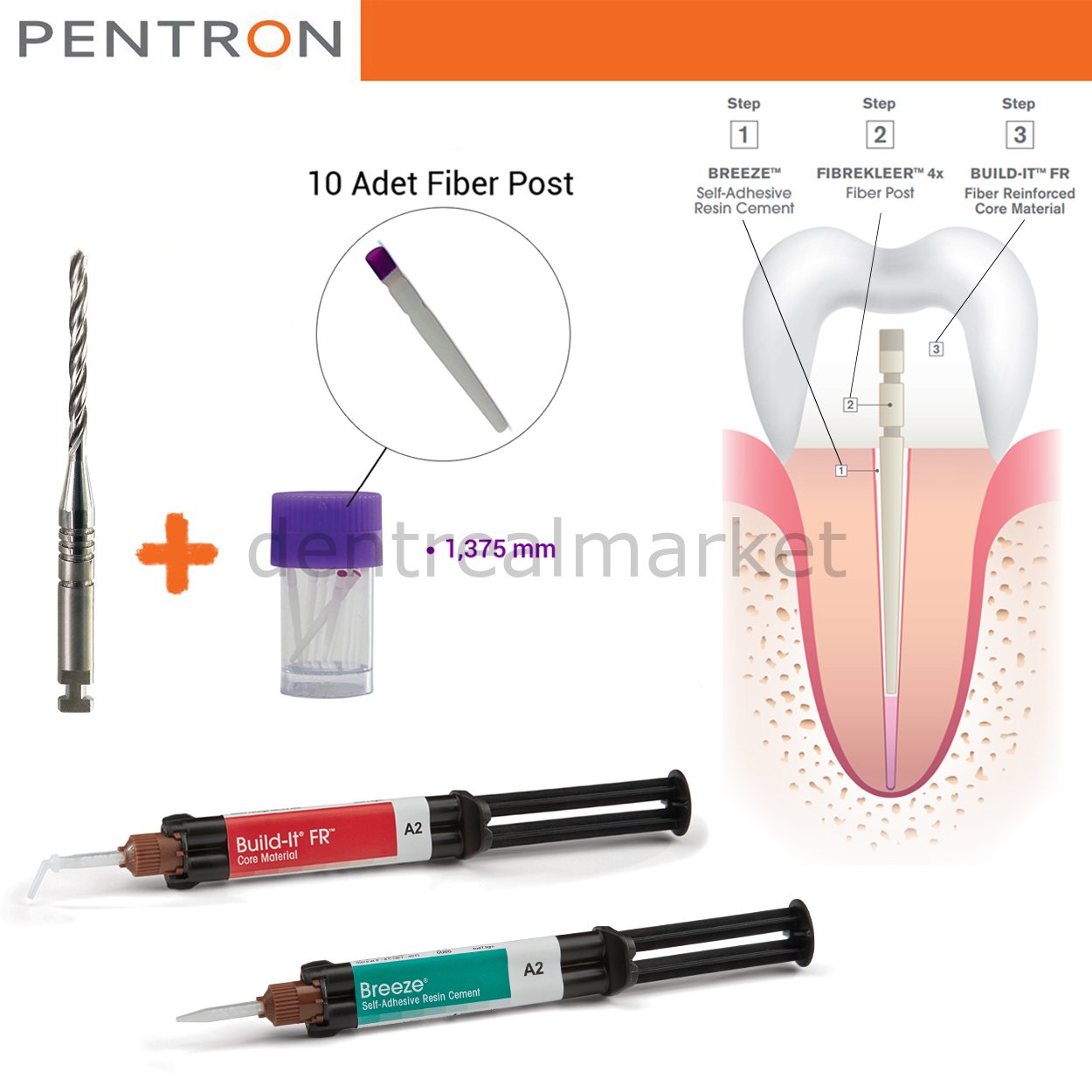 Post-Core Sistem Kit-FibreKleer Fiber Post 1.375mm- Breeze Self Adeziv-Build-it Kor Materyeli