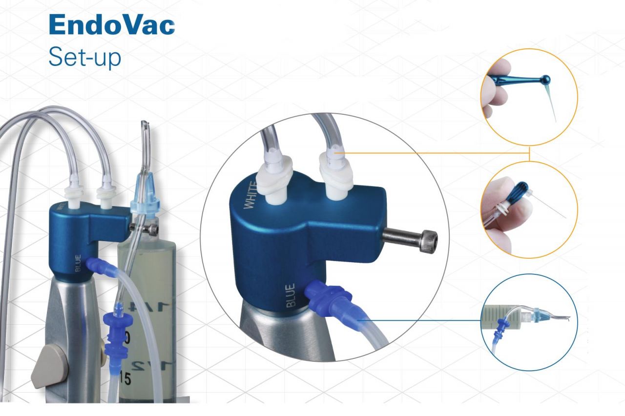 EndoVac İnstallation Kit