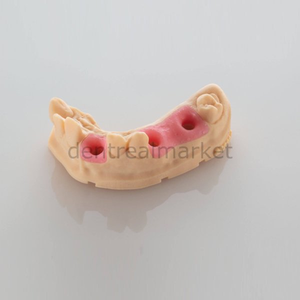 Ultracur 3D Gingiva Mask Model Reçinesi - 5 kg