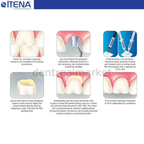 Dentotemp Automix İmplant Simanı 2 * 5 ml