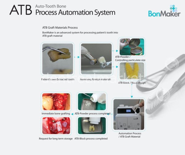 BonMaker ATB Greft Sistem