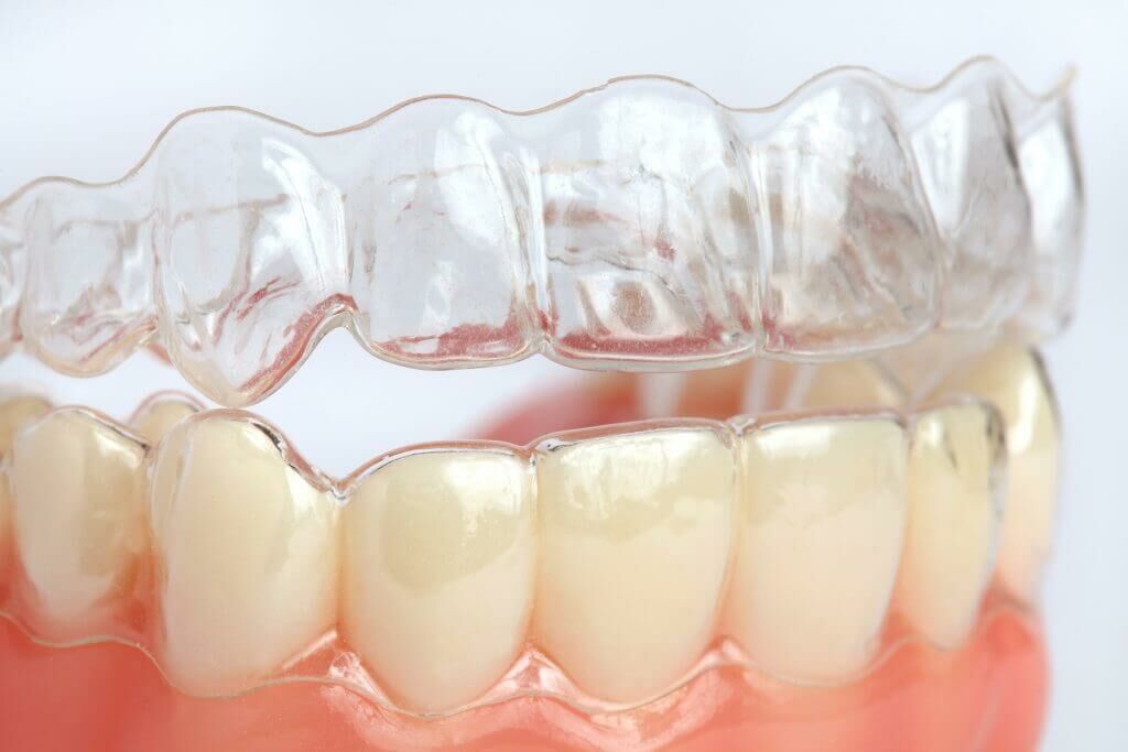 Diş Gıcırdatmama Aparatı: Gece Gıcırdatma Sorununa Etkili Bir Çözüm