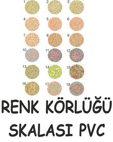 Renk Körlüğü Skalası