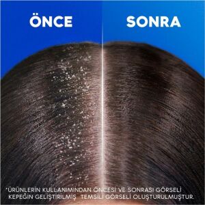 Head & Shoulders Şampuan Saç Dökülmelerine Karşı Etkili 750 ml